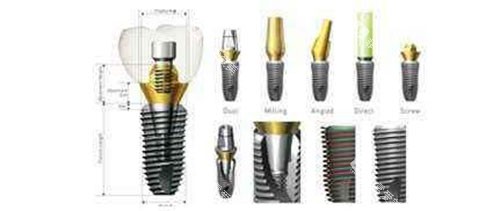 美国皓圣种植牙 美国皓圣种植牙