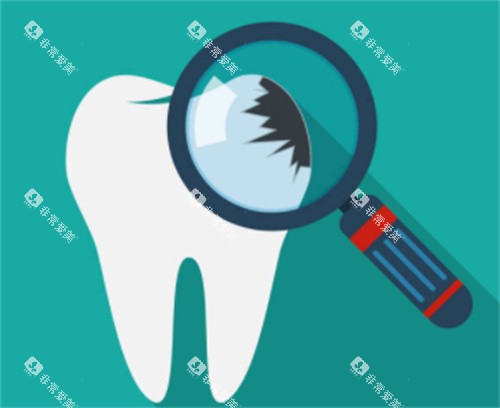 牙齿检查图 牙齿检查图