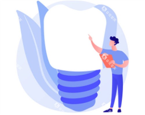 种植牙科普知识图