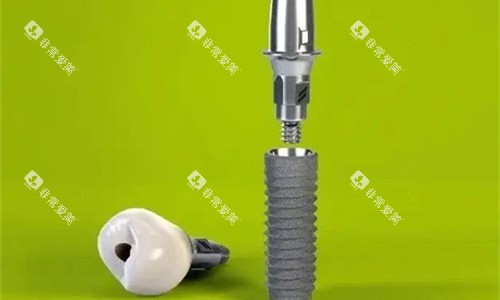 植体产品展示图 植体产品展示图