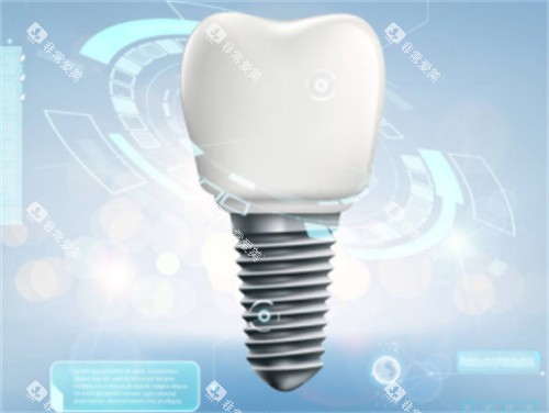 种植牙背景图 种植牙背景图