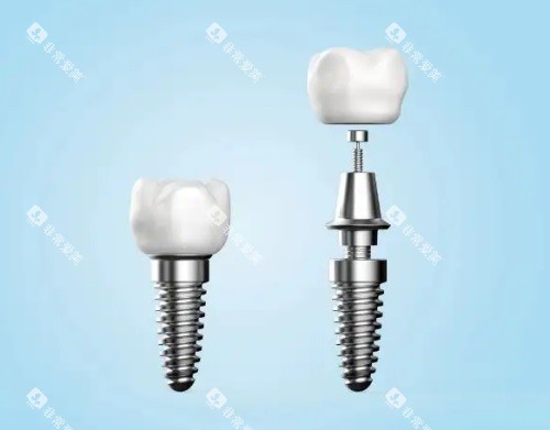 种牙组成图 种牙组成图