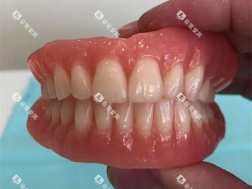 全口吸附性义齿实物图 全口吸附性义齿实物图