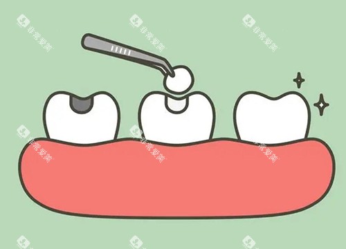 补牙改善照片示意