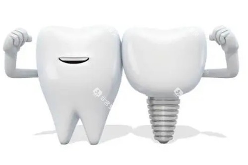 种植牙和真牙模型示意图