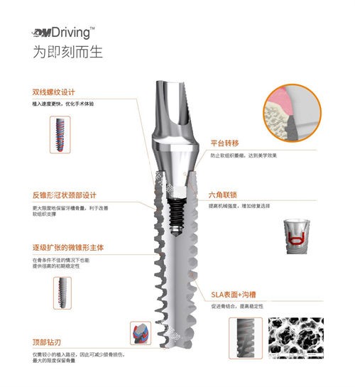 百齿泰DMDriving种植体优势介绍图