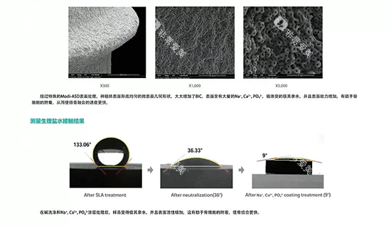 韩国inno伊诺种植牙好不好