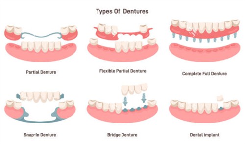 牙齿缺失示意图