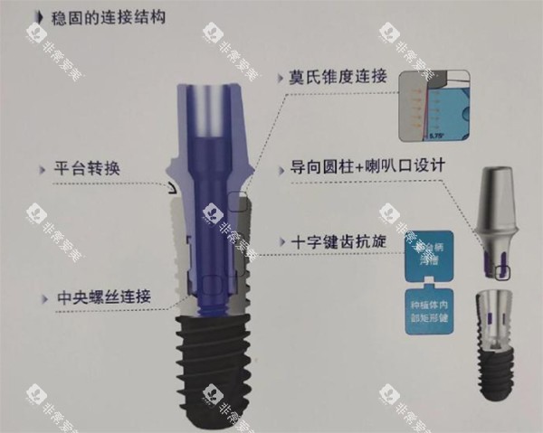 威高wego种植牙细节植体照片