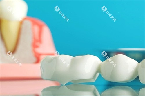 牙齿治疗材料图