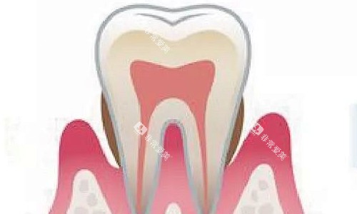 中午牙周炎展示