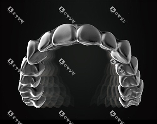 美立刻隐形牙套图示