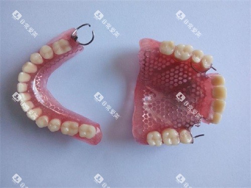 普通全口义齿假牙实物图 普通全口义齿假牙实物图
