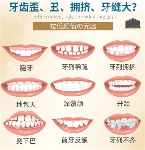 牙齿矫正适应症图示 牙齿矫正适应症图示