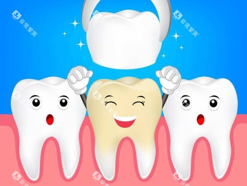 烤瓷牙义齿修复示意图