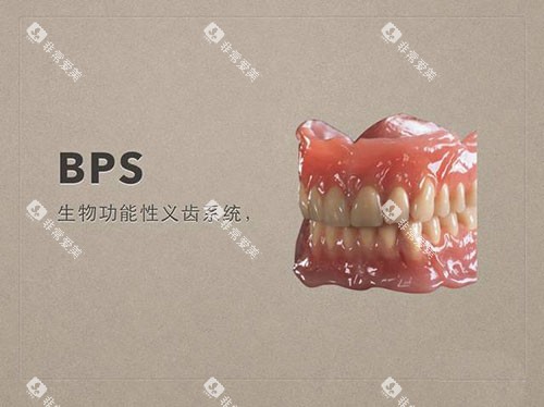 牙齿义齿吸附性义齿示意图