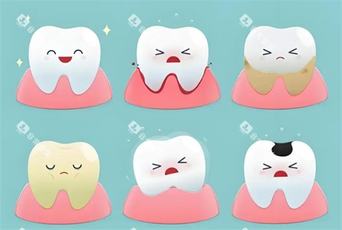 健康牙齿与不健康牙齿的状态 健康牙齿与不健康牙齿的状态