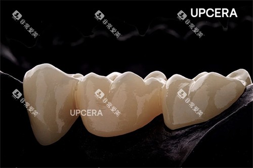 瓷倍健全瓷牙图示 瓷倍健全瓷牙图示