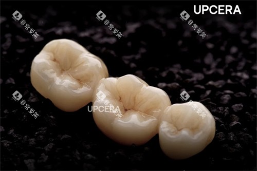 爱尔创-瓷倍健全瓷冠