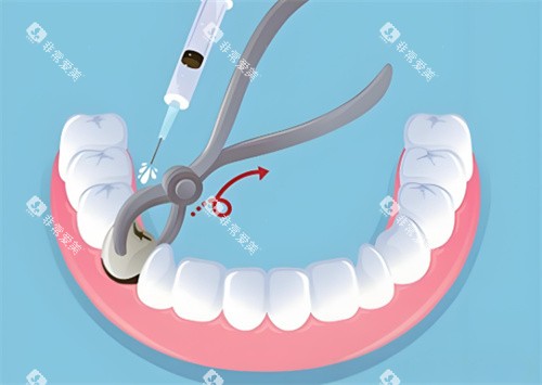 <span style= <span style=