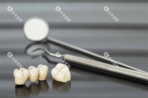牙齿检查工具和牙冠 牙齿检查工具和牙冠
