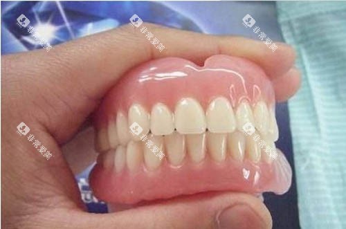 吸附性假牙图 吸附性假牙图
