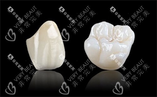 格莱美全瓷 格莱美全瓷