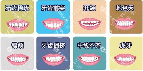 牙齿矫正不同适应症漫画图