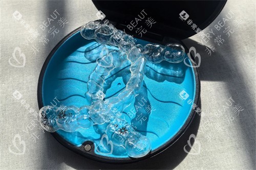 隐适美牙齿矫正